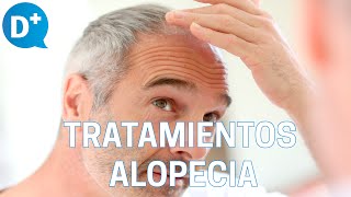 Tratamiento NATURAL para la ALOPECIA 🌿 Remedios caseros [upl. by Aryahay410]