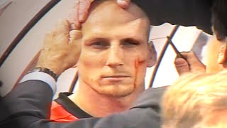 Jaap Stam eyebrow injury  EURO 2000 Netherlands v Czech Republic [upl. by Consolata]