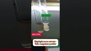 Tube coagulase test for Staphylococcus aureus staphylococcus tubecoagulase [upl. by Nesila]