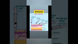 Types of injection sites💉🩻injectionsitesinjectionyoutubeshortsmedicaleducation [upl. by Eikcir289]