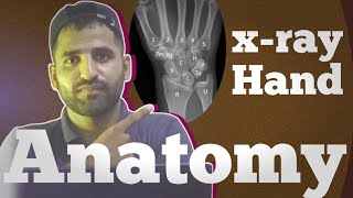 Xray Anatomy of Hand  carpal bones  metacarpal bones  technologisttalk804 [upl. by Maier]