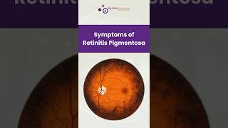 Symptoms of Retinitis Pigmentosa [upl. by Zilevi606]