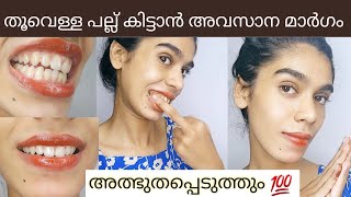 Shihana Shas ന്റെ teeth whitening powderറിസൾട്ട്‌ കിട്ടാത്തവർക്ക് വീട്ടിൽ കേറി വന്ന് അടിക്കാം😯 [upl. by Haze321]