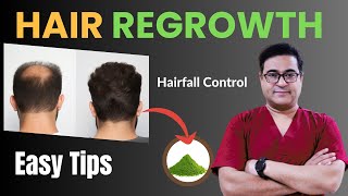 Guaranteed Hair Regrowth Tips by Dr Vikram  hairregrowth hairfall [upl. by Konstanze]