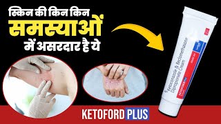 Ketoford Plus Cream Uses  Ketoconazole And Beclomethasone  Ketoconazole Cream For Fungal [upl. by Ylrebmyk]