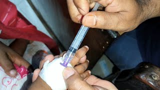 Child Meropenem 250mg amp Amikacin intravenous injection Video 24 Ep 71 Injection Tips [upl. by Salisbarry]