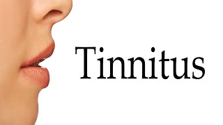 How To Say Tinnitus [upl. by Acireed288]