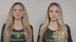 STEP BY STEP DETOX CAUTERIZATION ACQUACÔCO ENGLISH [upl. by Ainevuol]