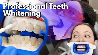 Teeth Whitening At The Dentist  Fastest Way To Whiten Your Teeth [upl. by Ronoh]