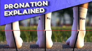 What is overpronation  Pronation types explained [upl. by Drofub266]