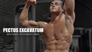 PECTUS EXCAVATUM  BODYBUILDING [upl. by Asoj]