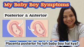 My Baby Boy Symptoms in pregnancy  Placenta Position se pata chalta hai baby ka gender [upl. by Amaso]