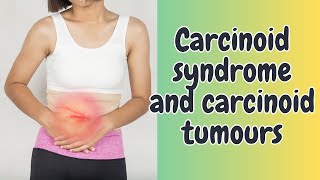 Carcinoid syndrome and carcinoid tumours [upl. by Asher]