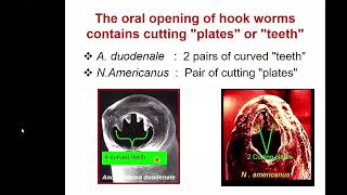 Hook Worm Infection  Parasitology lecture Necator americanus and Ancylostoma duodenale [upl. by Lancey]