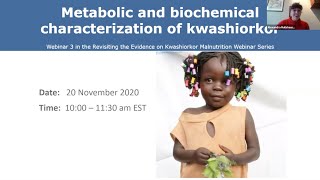 Revisiting the Evidence on Kwashiorkor Metabolic and Biochemical Characterization of Kwashiorkor [upl. by Edalb]