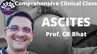 ASCITES Clinical case presentation [upl. by Mitman]