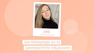 Spondylarthrite Ankylosante  Témoignage de Léa [upl. by Llovera]