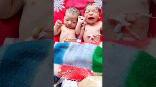 Cute Twin babies Vs Funny Twin Babies Lovely Moments AfterBirth [upl. by Hu927]