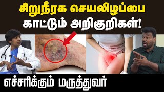 Health care கிட்னி Failureஐ சரி செய்ய முடியுமா  விளக்கும் மருத்துவர்  Positivitea [upl. by Eilarol]