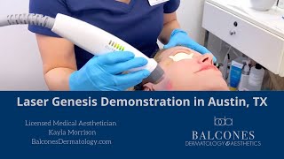 Laser Genesis Treatment Demo  Balcones Dermatology amp Aesthetics Austin TX  Ph5124594869 [upl. by Anyrtak]