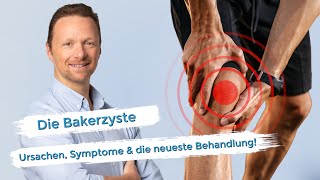 Bakerzyste  Die neueste Behandlungsmethode [upl. by Geanine984]