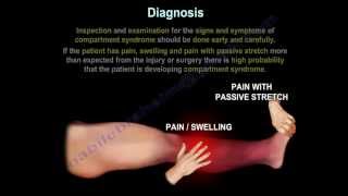 Compartment SyndromeDiagnosisPressuresFasciotomy Everything You Need To Know Dr Nabil Ebraheim [upl. by Amby]