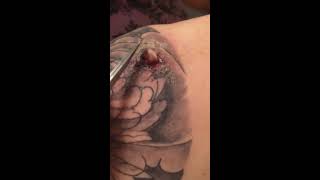 Infected abscess on tattoo [upl. by Remliw100]