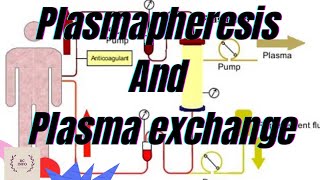 Plasmapheresis part1Plasma exchangeTherapeutic plasma exchangetherapeutic plasmapheresisTPEPE [upl. by Len]