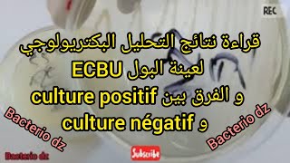 قراءة نتائج التحليل البكتريولوجي لعينة البول ecbu و الفرق بين culture positif و culture négatif [upl. by Nereil]