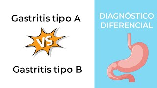 Diagnóstico Diferencial Gastritis tipo A vs Gastritis tipo B [upl. by Liddle]