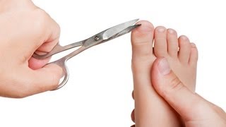 How to Get Rid of Toenail Fungus Fast at Home  7 Natural Remedies to Treat Fungal Toenails [upl. by Dragde]