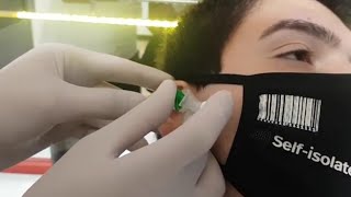 Kıkırdak Helix Piercing Delimi Sonrası Bakım Ve İyileşme [upl. by Nagirrek719]