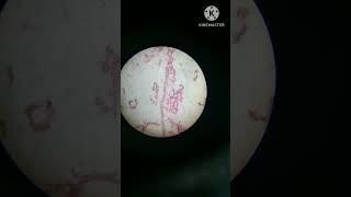 Sycon in microscope like subscribe for more videos BSc [upl. by Uchida]