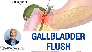 Gallbladder Flush  The true science behind the myth [upl. by Tirzah]