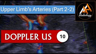 10  Upper Limbs Arteries Part 22 [upl. by Uot]