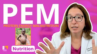 Protein Energy Malnutrition PEM Nursing School Nutrition Essentials Education  LevelUpRN [upl. by Laerol]