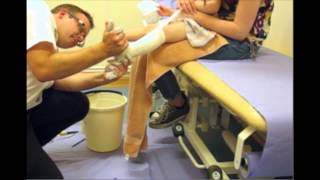 Ankle Foot Orthosis AFO Casting [upl. by Bushweller]