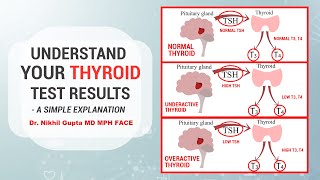 Hypothyroidism or Hyperthyroidism Thyroid Function Test Results explained  Dr Nikhil Gupta MD [upl. by Ellenhoj407]