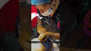 Hair Transplant clinic in Delhi  dr Nandini Dadu ￼ [upl. by Calisa]