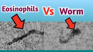 How Eosinophils Coat a Worm [upl. by Niwdog]