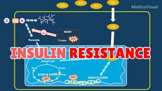 Insulin Resistance Part 2 Basal Lipolysis Free Fatty Acids and Randle cycle Hypothesis [upl. by Wylie483]