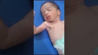 Newborn baby born with suspension of down syndrome just after birth 32kg weight [upl. by Lebiram243]