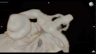 Cochlea  Inner Ear 3D MRI：内耳、蝸牛、三半規管 [upl. by Margaret]