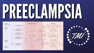 Preeclampsia Explicada Claramente [upl. by Helban]