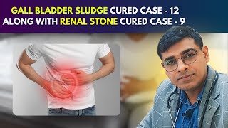 Gall Bladder Sludge Cured Case  12 Along With Renal Stone Cured Case  9  Dr Abhik Ghosh [upl. by Vadim799]