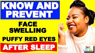 What Causes Face SWELLING And PUFFY RED EYES After SLEEP  Daily MED Facts Of Human Life [upl. by Goar]