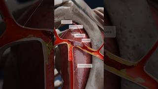 Thrombosis 3D animation  clot formation in the subclavian artery [upl. by Betta612]