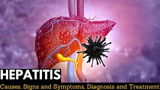 Hepatitis Causes Signs and Symptoms Diagnosis and Treatment [upl. by Henleigh]