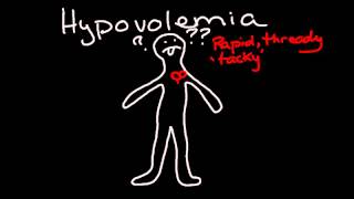 Hypovolemia [upl. by Aicenad]