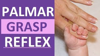 Palmar Grasp Reflex Reaction Infant Newborn Pediatric Nursing Assessment [upl. by Jack]